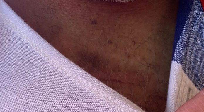 Advokat Pembela HAM Yan Christian Warinussy Ditembak OTK di Manokwari